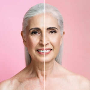 Antiaging